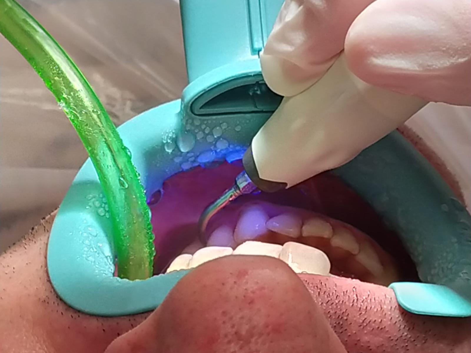 Igiene dentale