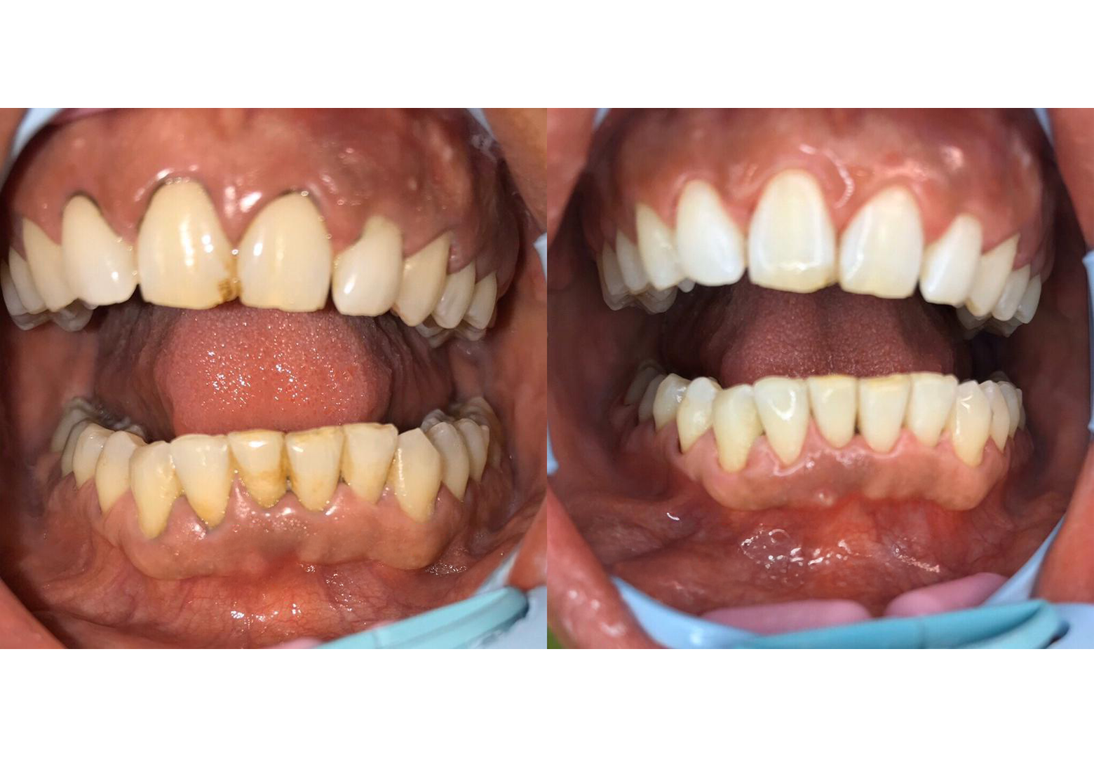 igiene dentale 1
